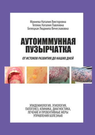 Людмила Белецкая, Наталия Махнева, Наталия Теплюк, Аутоиммунная пузырчатка. От истоков развития до наших дней