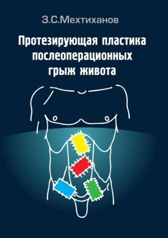 Зубаир Мехтиханов, Протезирующая пластика послеоперационных грыж живота