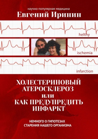 Евгений Иринин, Холестериновый атеросклероз, или Как предупредить инфаркт. Немного о гипотезах старения нашего организма