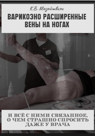 Константин Мазайшвили, Варикозно расширенные вены на ногах и всё с ними связанное, о чём страшно спросить даже у врача