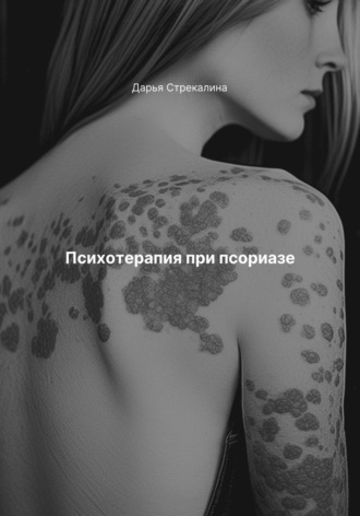 Психотерапия при псориазе Дарья Стрекалина, Психотерапия при псориазе